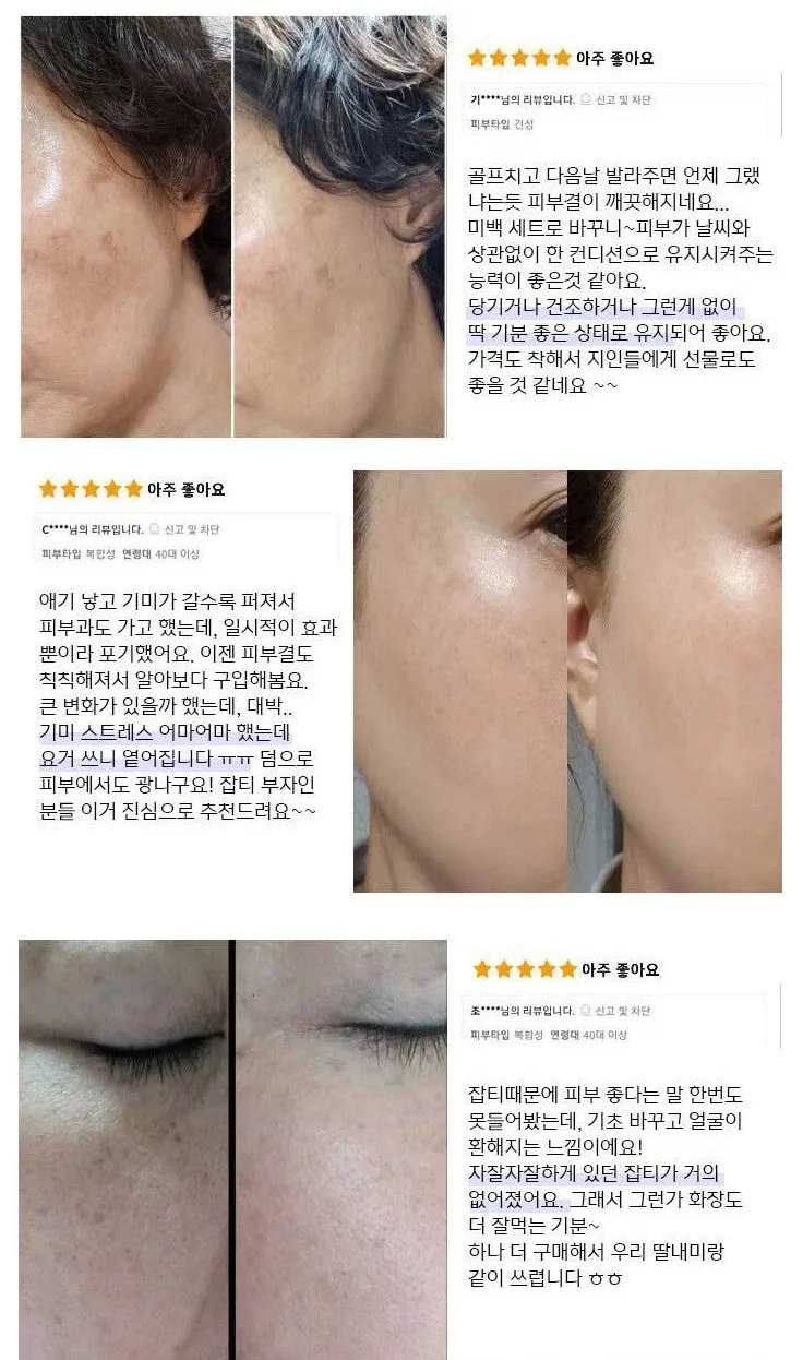 Anjo The White Skin care 6 Sets Signature Hyaluronic Blemish Glutathione Anti-ageing Wrinkles Dark Circles Finelines Gifts Whitening Brightening