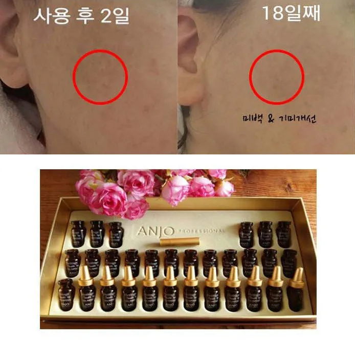 Anjo Vitamins C E Capsules Ampoule Sets 2ml 30ea Anti-ageing Wrinkles Dark Circles Finelines Gifts Snail