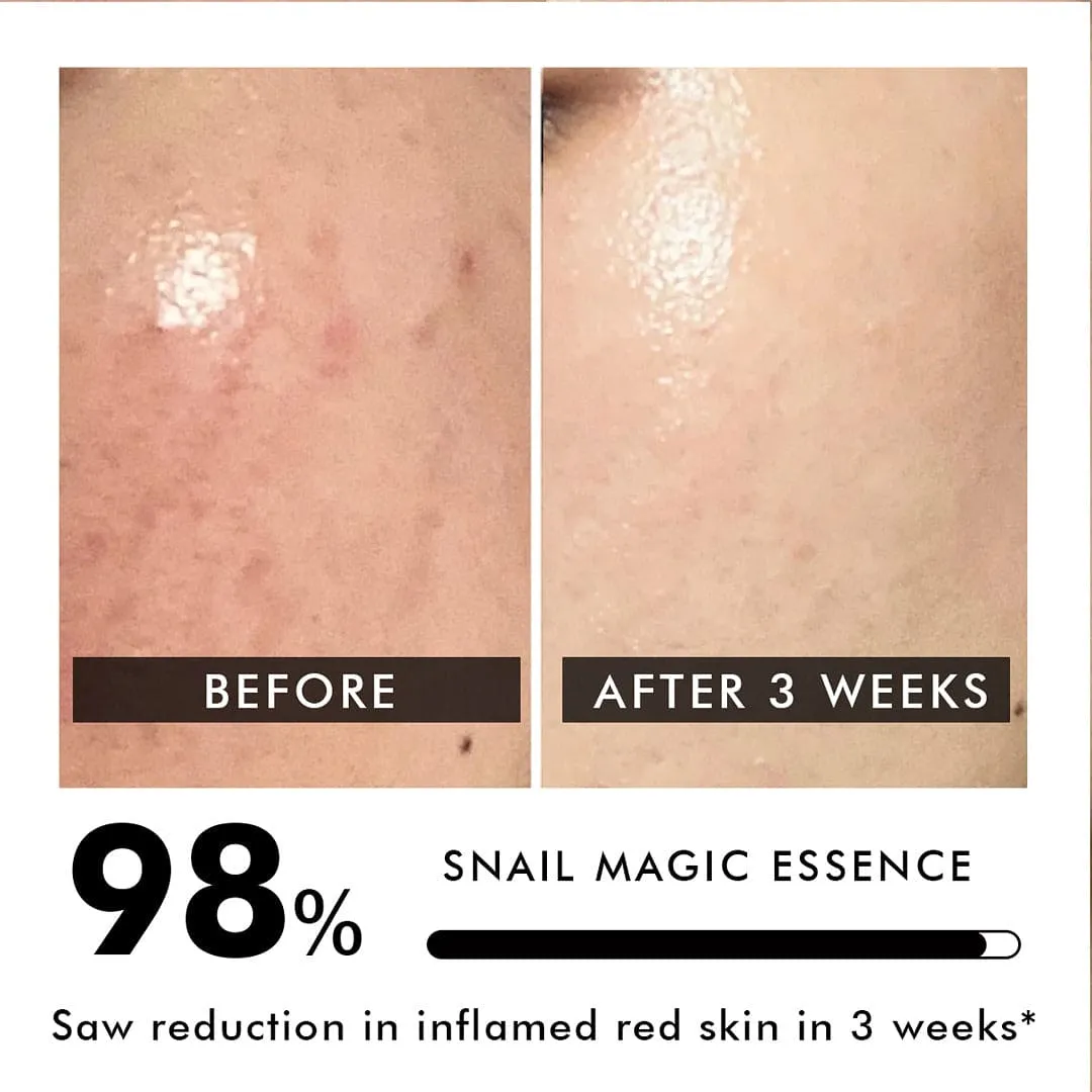 Snail Magic Essence | Barrier Repair | 97% Concentrated Snail Mucin