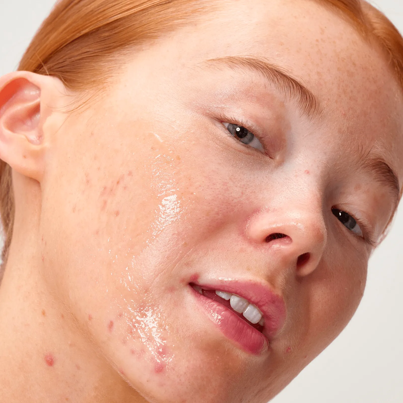 The Inkey List | Apple Cider Vinegar Acid Peel 30ml