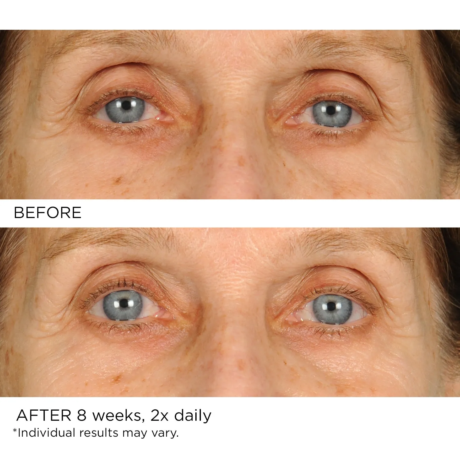 Undereye Anti-Aging Smoother