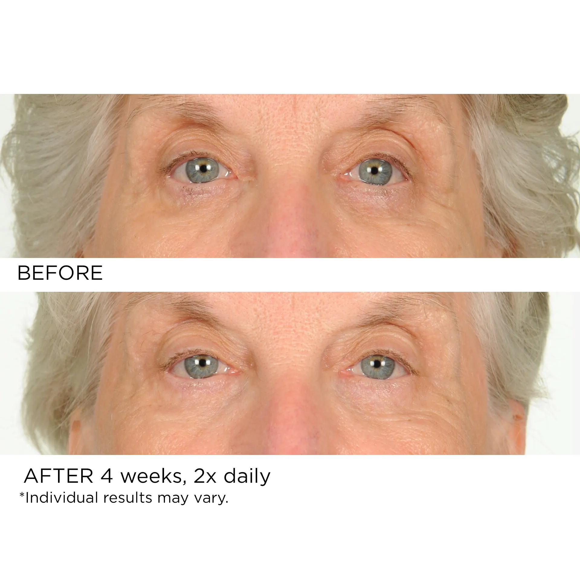 Undereye Anti-Aging Smoother