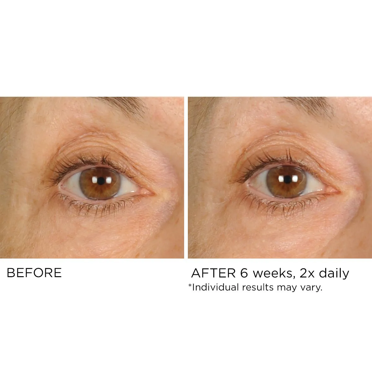 Undereye Anti-Aging Smoother