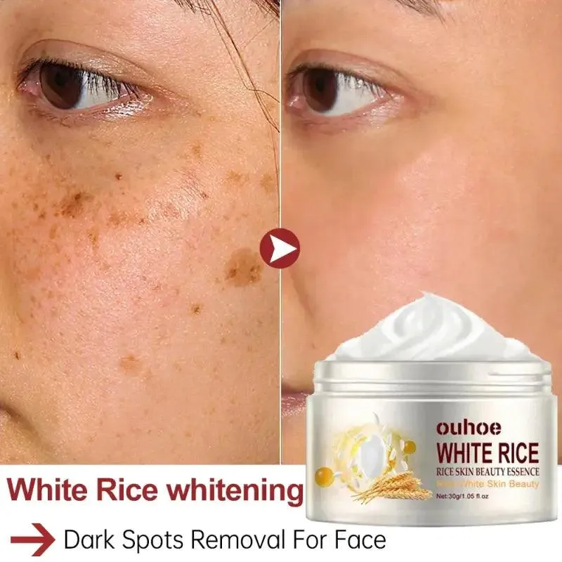 White Rice Whitening Face Cream: Removes Dark Spots, Anti-wrinkle